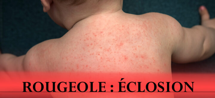 Sensibilisation à l’éclosion de la rougeole au Québec